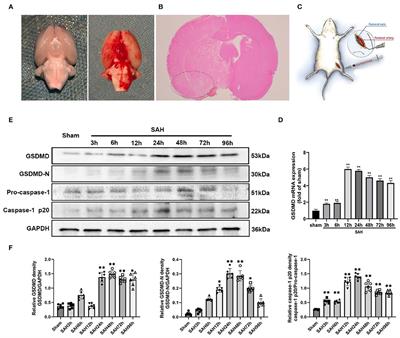 Dexmedetomidine Inhibits Gasdermin D-Induced Pyroptosis via the PI3K/AKT/GSK3β Pathway to Attenuate Neuroinflammation in Early Brain Injury After Subarachnoid Hemorrhage in Rats